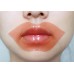 SOS! My Lip Patch Маска-патч для губ с коллагеном 1 шт