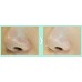 So Natural Pore Tensing Carbonic Bubble Pop Clay Mask Кислородная маска на основе французской белой глины