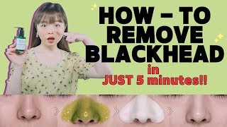 HOW-TO: REMOVE BLACKHEADS in JUST 5 MINUTES!! ✨