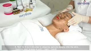 STORYDERM TIMEMACHINE PEEL (STORYDERM_KOREA) / beauty / Cosmetic